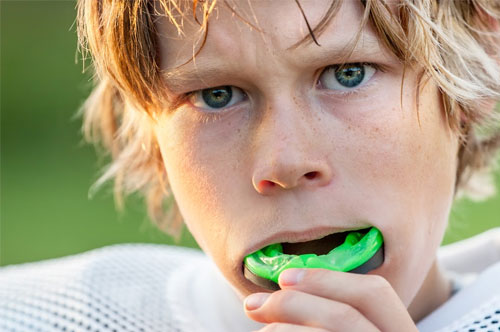 Get a Custom Mouthguard for Your Child Athlete This Fall